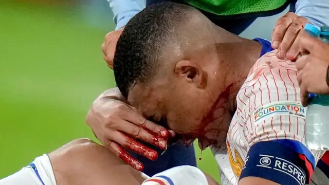 Kylian Mbappé missar resten av gruppspelet